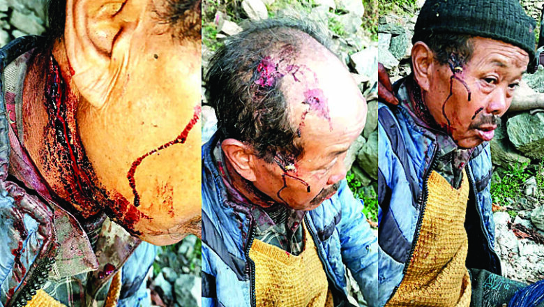 आराकोट बंगाण: भालू के हमले में नेपाली मूल का चौकीदार गंभीर रूप से घायल